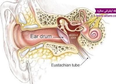 التهاب یا عفونت گوش چیست؟