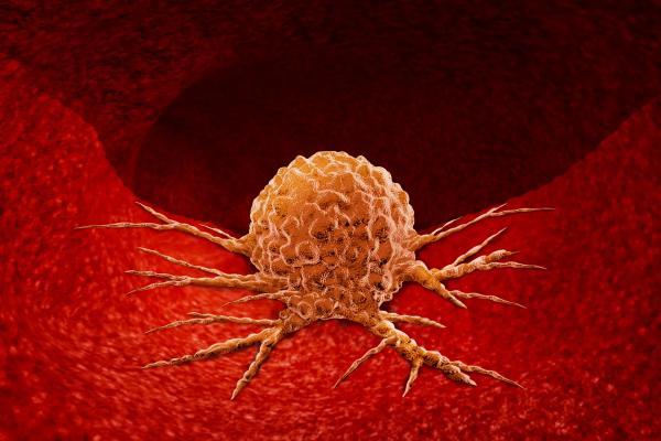 نتایج کارآزمایی موفقیت آمیز دارویی برای مهار ژن شایع سرطان زا: به امید مهار ژن MYC